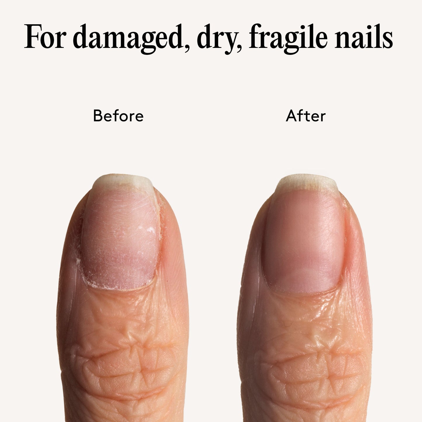 Mylee TLC Nail Serum