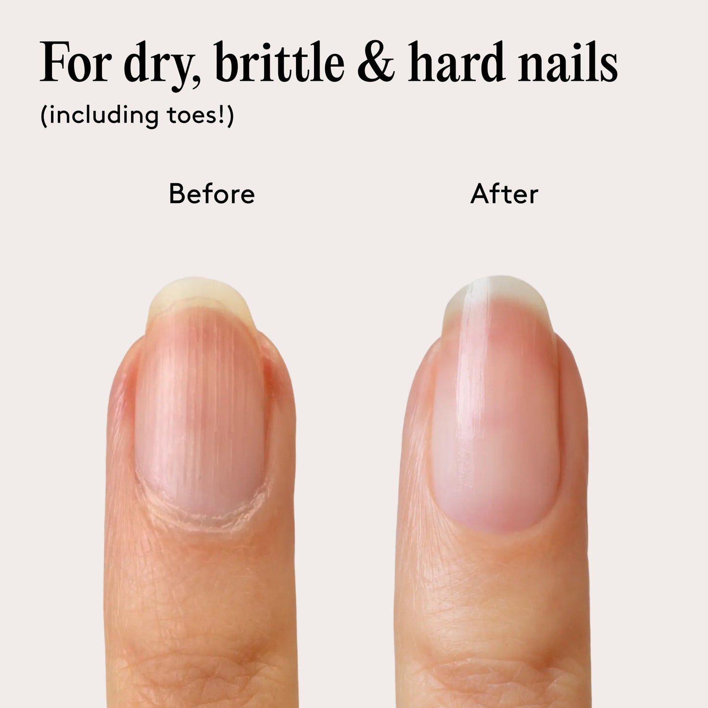 Mylee Barrier Boost Nail Serum